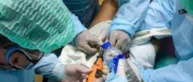 joven murió tras poner pegamento en su pene Murió tras poner pegamento en sus genitales