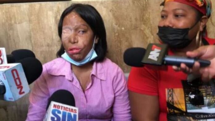 Yocairi Amarante víctima de ataque con ácido del diablo