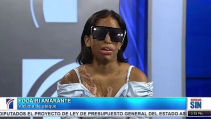 Caso Yocairi Amarante - Destacada Color Visión Yocairi Amarante