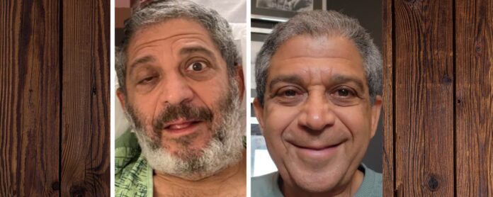 Miastenia Gravis Miastenia Gravis