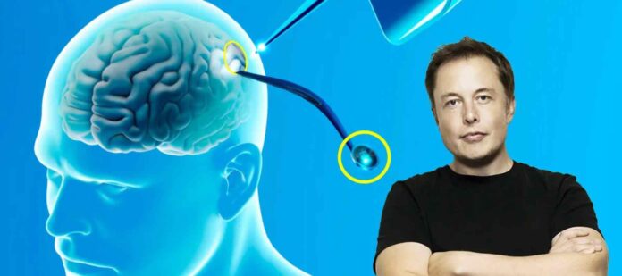Neuralink-logra-exitosamente-el-primer-implante-de-chip-cerebral-en-un-ser-humano Neuralink-logra-exitosamente-el-primer-implante-de-chip-cerebral-en-un-ser-humano