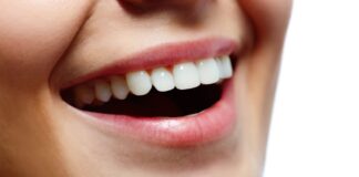¿quieres lucir una mejor sonrisa pon en práctica estos 5 consejos
